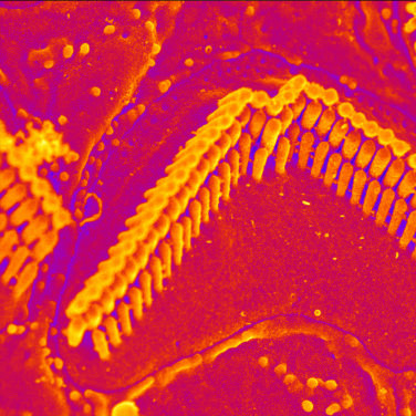 Stereocilia from the outer hair cells of the inner ear.