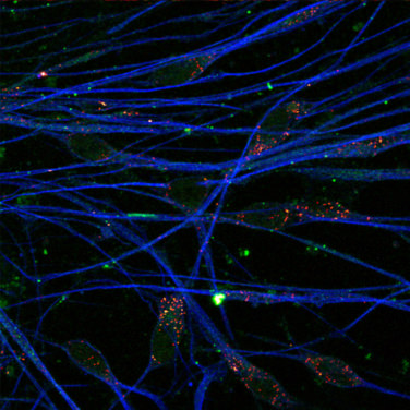 Axons and neurons of the inner ear, with axons shown in blue.