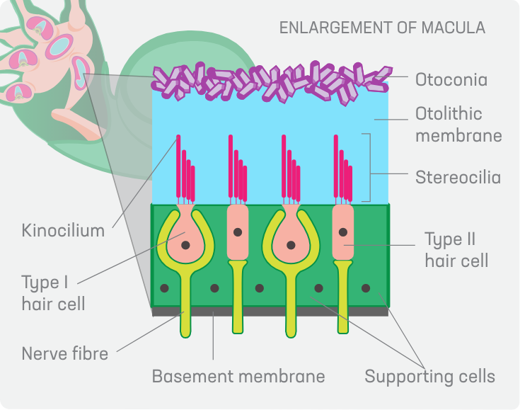 Enlargement of Macula