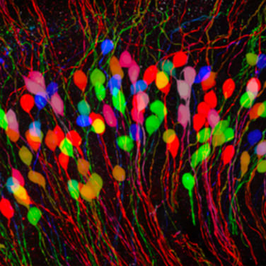 Spiral ganglion neurons isolated from a mouse cochlea.